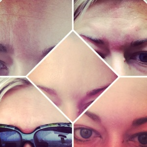 My beautiful results after just 5 days, clockwise from top left and ending in center.